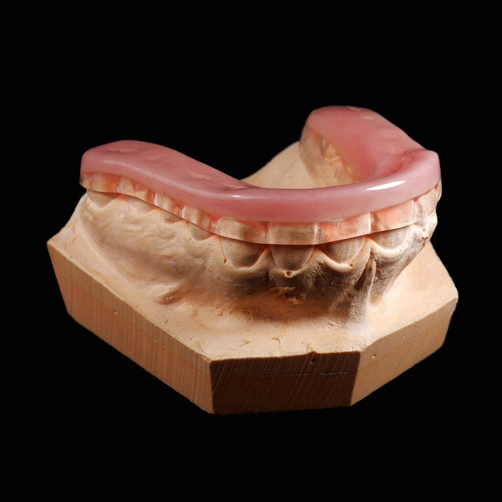Férula de Descarga Tipo Michigan - Bruxismo - Dentista en Móstoles